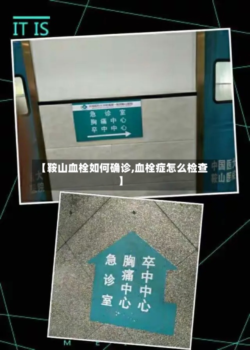 【鞍山血栓如何确诊,血栓症怎么检查】-第3张图片