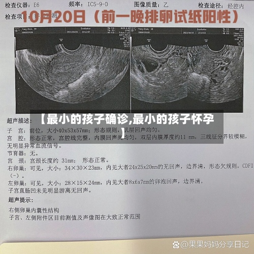 【最小的孩子确诊,最小的孩子怀孕】