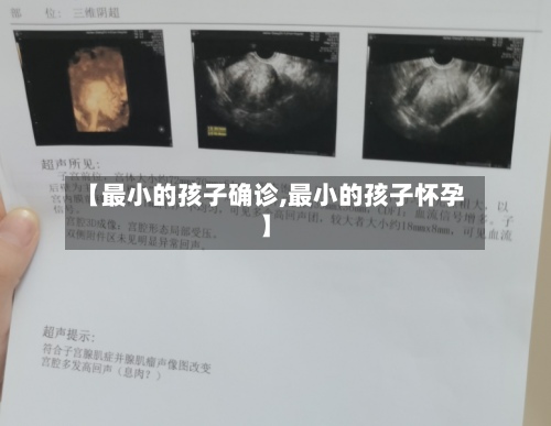 【最小的孩子确诊,最小的孩子怀孕】-第2张图片
