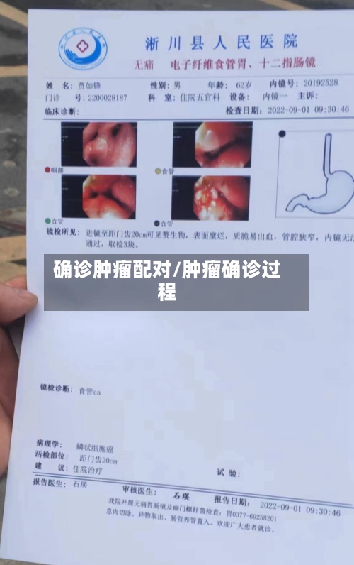 确诊肿瘤配对/肿瘤确诊过程-第2张图片