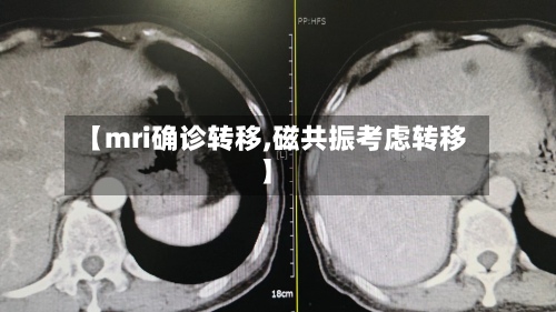 【mri确诊转移,磁共振考虑转移】-第2张图片