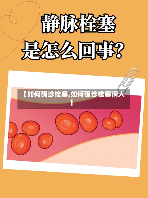 【如何确诊栓塞,如何确诊栓塞病人】
