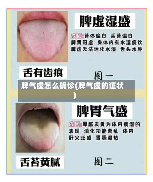 脾气虚怎么确诊(脾气虚的证状)-第2张图片