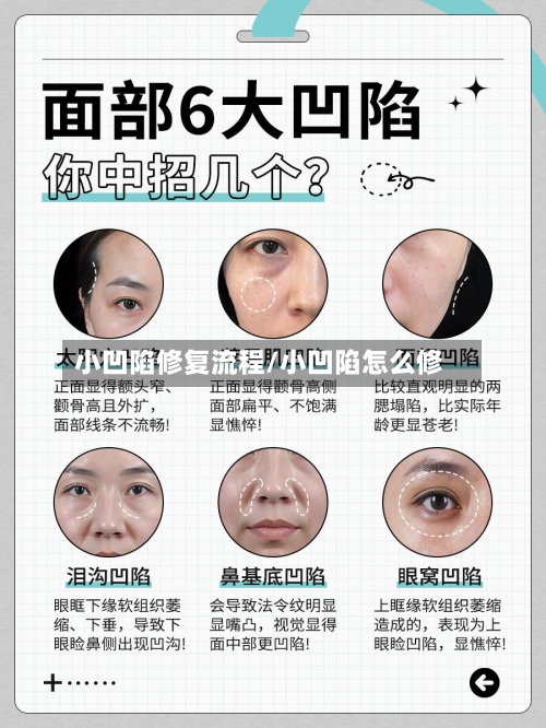 小凹陷修复流程/小凹陷怎么修
