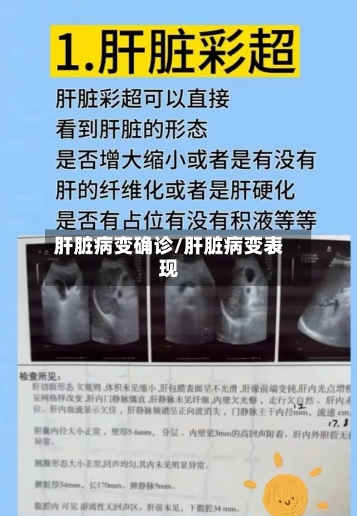 肝脏病变确诊/肝脏病变表现-第1张图片