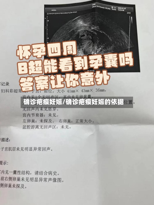 确诊疤痕妊娠/确诊疤痕妊娠的依据-第3张图片