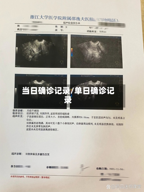 当日确诊记录/单日确诊记录-第3张图片